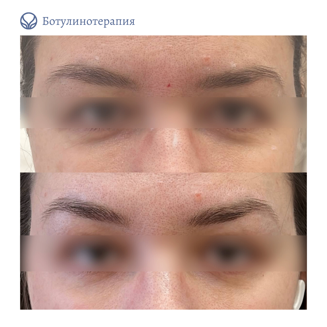 62014032__https://filllin.ru/api/media/doctor/01321701-14e2-41c3-8ec7-359b2bad574f-6641d6971b708b73903b2c1d.png