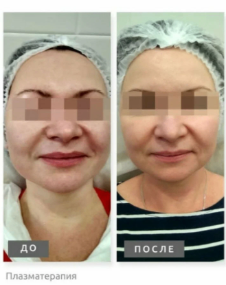 208505714__https://filllin.ru/api/media/doctor/03ba7493-7711-4f58-800b-b7b0d6083f70-6641d6971b708b73903b2c1d.png