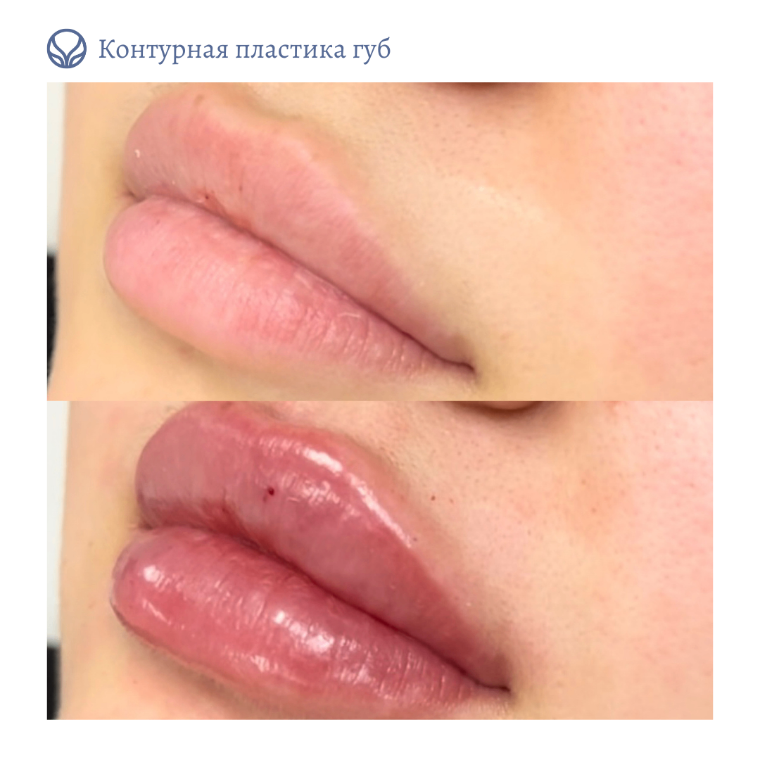63550010__https://filllin.ru/api/media/doctor/07ba55fc-9ee6-4baf-999a-c0a6fe754d1a-6641d6971b708b73903b2c1d.png