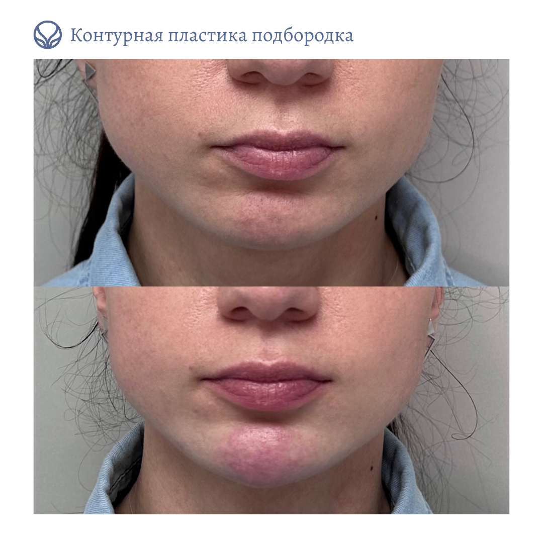 64844681__https://filllin.ru/api/media/doctor/085c9813-a7d9-4528-8be6-7200c3a9dc09-6641d6971b708b73903b2c1d.png
