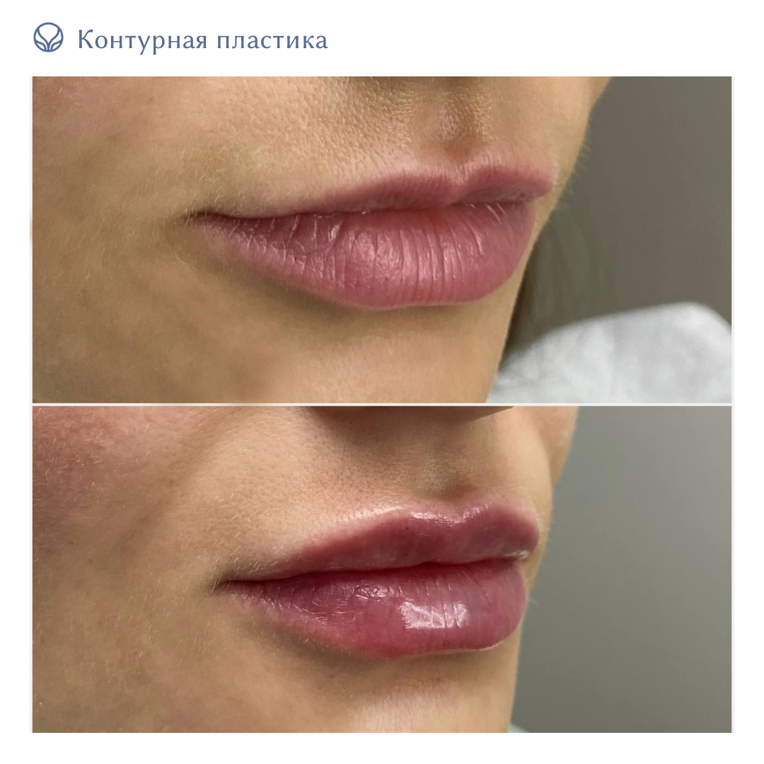 64844681__https://filllin.ru/api/media/doctor/0b22588a-300c-49a4-9cd6-af1bd31b67b9-6641d6971b708b73903b2c1d.png