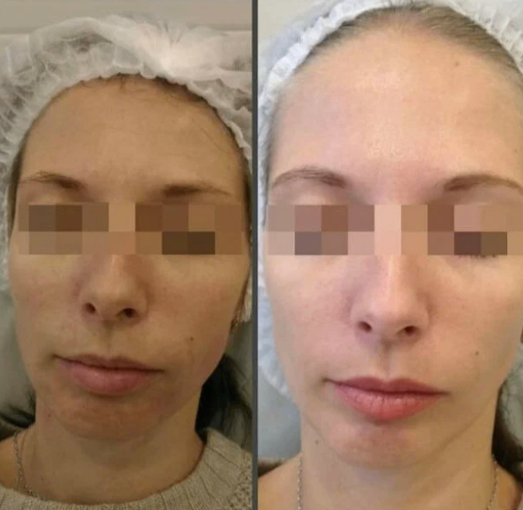 209002201__https://filllin.ru/api/media/doctor/0c651ac4-08bf-4ce6-b92e-b880eac94afb-6641d6971b708b73903b2c1d.png