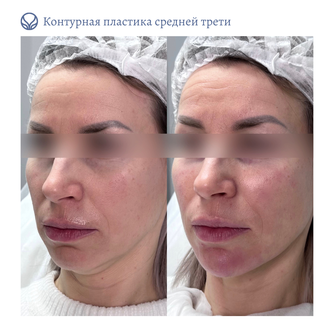 64844681__https://filllin.ru/api/media/doctor/0f7324a6-70f0-436c-9398-dd9f176c1e22-6641d6971b708b73903b2c1d.png