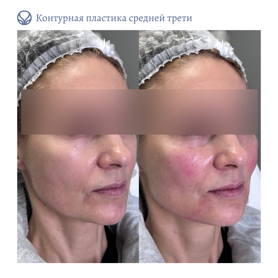 64844681__https://filllin.ru/api/media/doctor/0fdd1c69-fca1-4637-ace4-5d4ddde2d50b-6641d6971b708b73903b2c1d.png