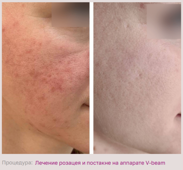 602492197__https://filllin.ru/api/media/doctor/114d46ee-1248-4521-8f04-4707166454be-68d2b334d611ae3c0dcef079.png