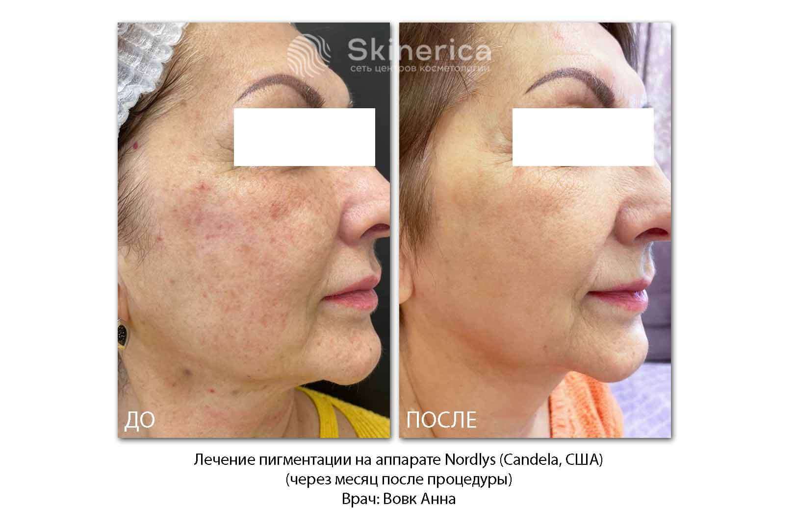 210725569__https://filllin.ru/api/media/doctor/126ae2e1-d836-4fbf-8a9b-51416d775015-6641d6971b708b73903b2c1d.jpg