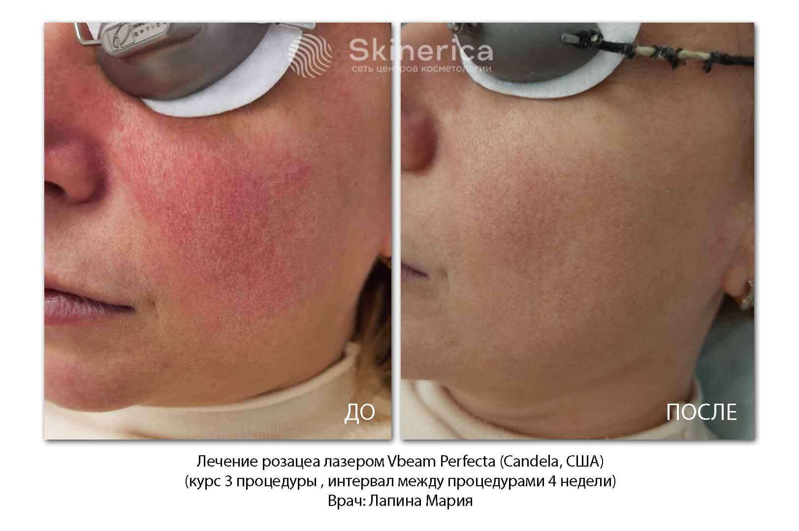 210725569__https://filllin.ru/api/media/doctor/189959f6-a596-406a-8851-3a150930cd73-6641d6971b708b73903b2c1d.jpg