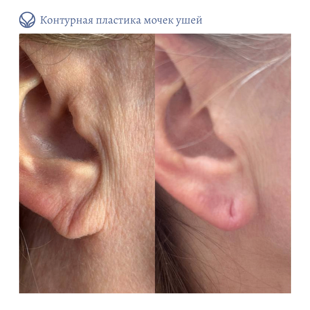 63423279__https://filllin.ru/api/media/doctor/19452274-782b-4ecd-83bf-727d9b8254d6-6641d6971b708b73903b2c1d.png