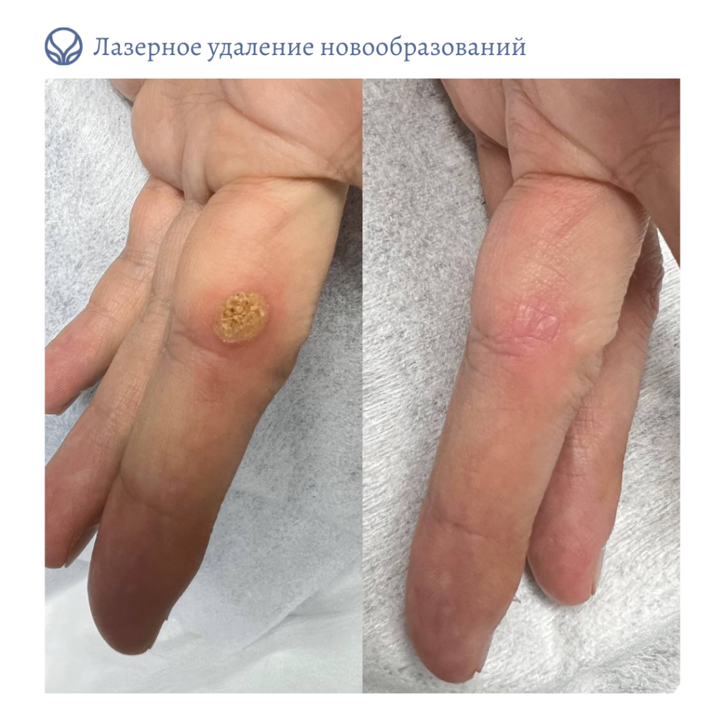 64764445__https://filllin.ru/api/media/doctor/1a5f2671-b95e-4c51-8070-5711d02775af-6641d6971b708b73903b2c1d.png