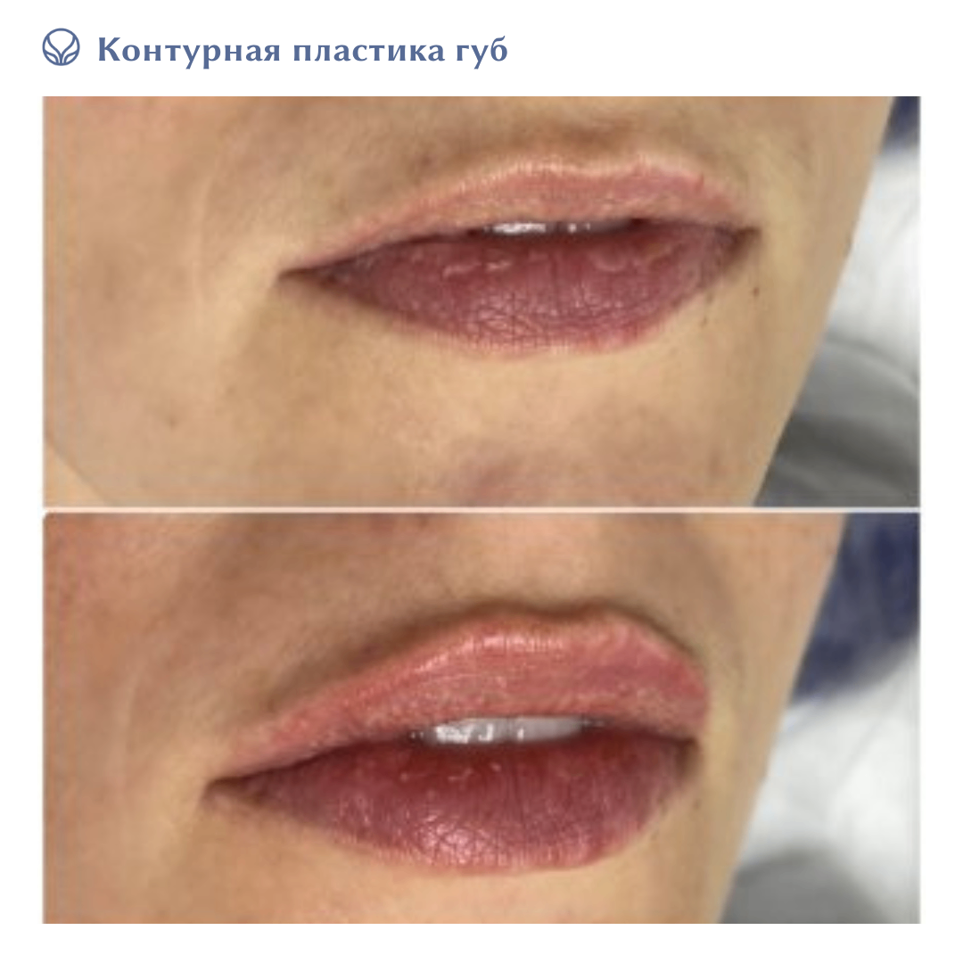 75035740__https://filllin.ru/api/media/doctor/1cc43d43-ac6b-433c-b621-d13675874398-6641d6971b708b73903b2c1d.png