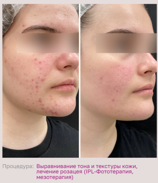 600558844__https://filllin.ru/api/media/doctor/1d592200-a4ff-4ec0-888f-43878f01fe5c-68d2b334d611ae3c0dcef079.png