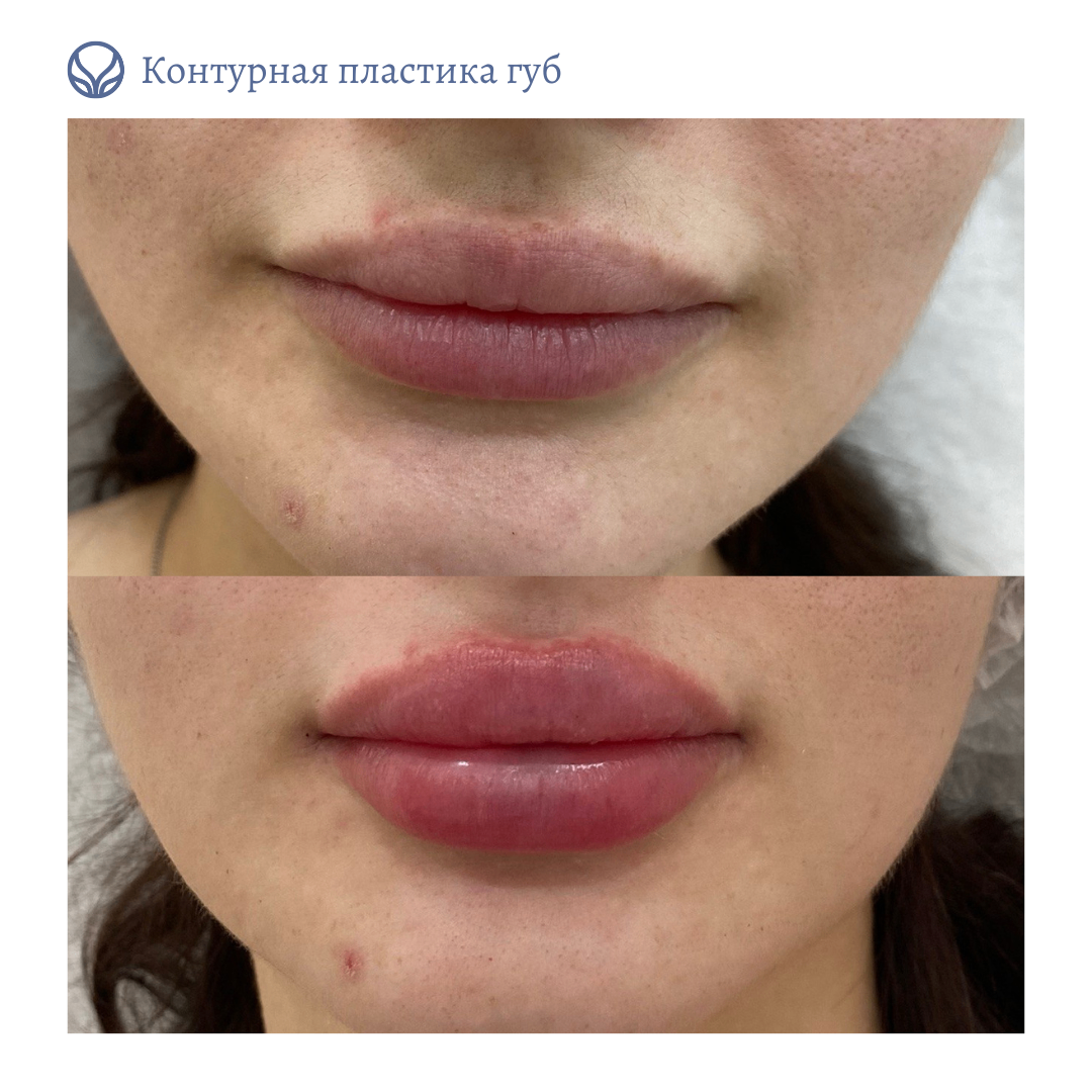 68347819__https://filllin.ru/api/media/doctor/1f9d14d7-ab4c-4670-a972-1796366a7726-6641d6971b708b73903b2c1d.png