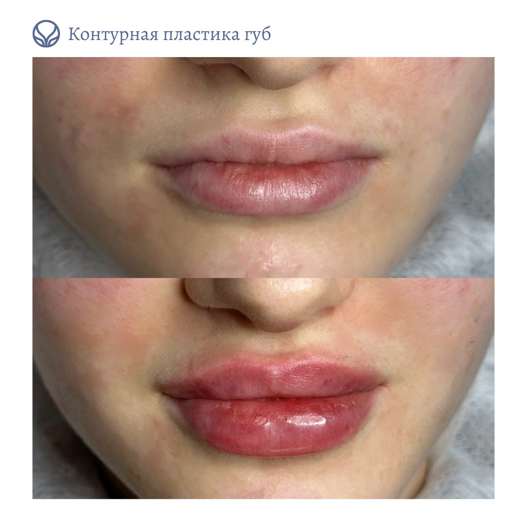 63423279__https://filllin.ru/api/media/doctor/20556a97-958d-49fc-8d11-c2b2b7f924bb-6641d6971b708b73903b2c1d.png