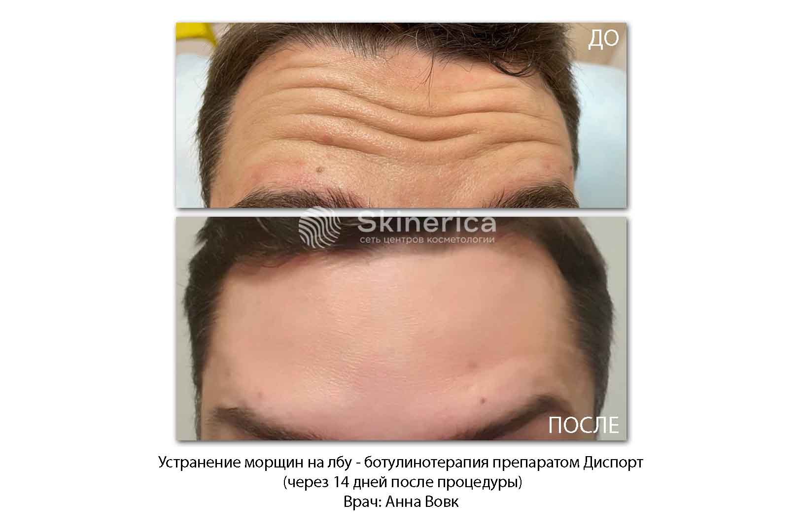 211990219__https://filllin.ru/api/media/doctor/20a261df-17e2-472a-aba1-3abf28cd8617-6641d6971b708b73903b2c1d.jpg