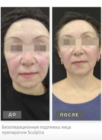 209665964__https://filllin.ru/api/media/doctor/2377dd2a-bd4f-4ab1-a9fa-ae9ddacdb0af-6641d6971b708b73903b2c1d.png