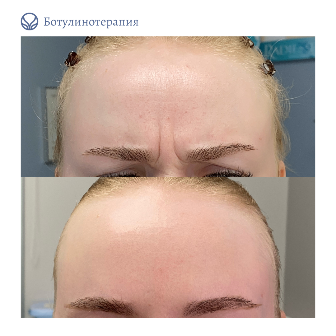62014032__https://filllin.ru/api/media/doctor/23de1a60-0a13-4318-96c7-205d60fa6e35-6641d6971b708b73903b2c1d.png