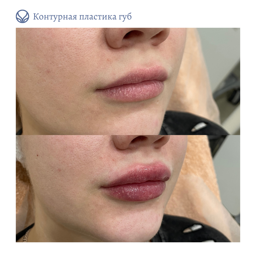 68347819__https://filllin.ru/api/media/doctor/2499adc5-e2f3-4b4f-ad93-4348393314da-6641d6971b708b73903b2c1d.png