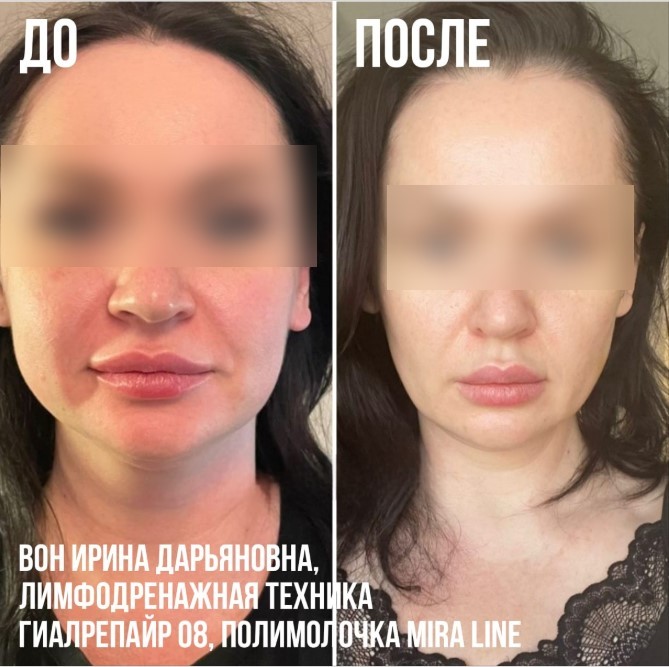 459598206__https://filllin.ru/api/media/doctor/264c2fba-fa3e-42dc-a600-bbaa5441eff1-6641d6971b708b73903b2c1d.jpg