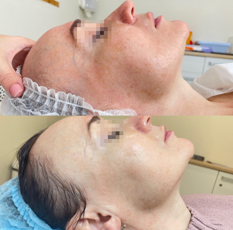 209002201__https://filllin.ru/api/media/doctor/28eabfa9-99be-473b-b33e-9f3b47a42194-6641d6971b708b73903b2c1d.png