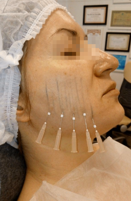 130966449__https://filllin.ru/api/media/doctor/2a84580b-678d-44ae-a9e5-8cb6c2e98ee1-6641d6971b708b73903b2c1d.png