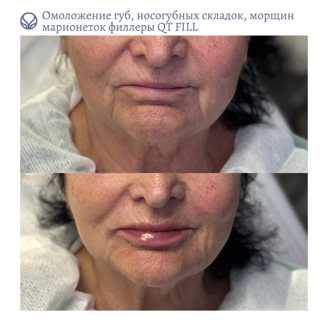 63423279__https://filllin.ru/api/media/doctor/2b116576-bf89-4a6b-bec0-6783b435582c-6641d6971b708b73903b2c1d.png