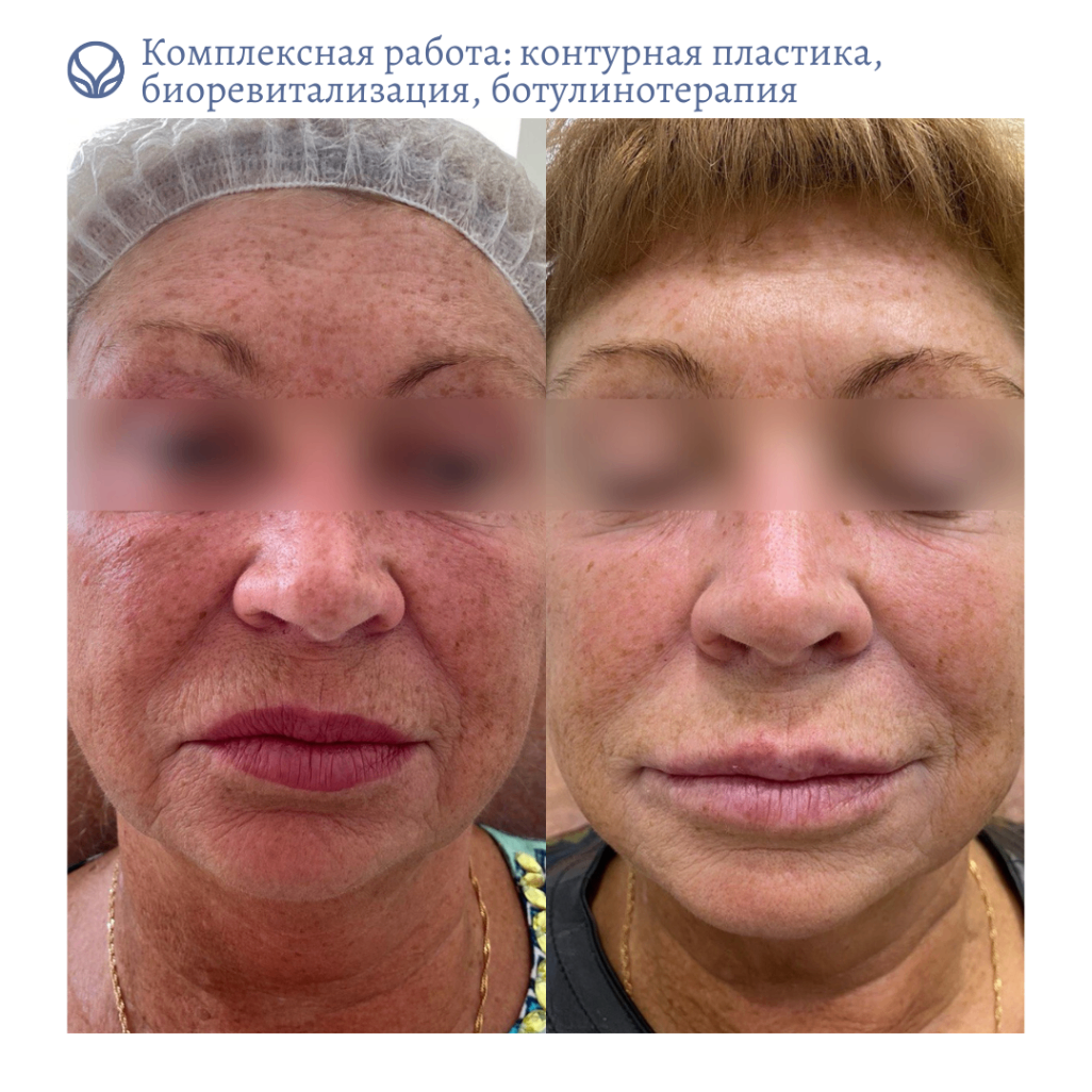 68347819__https://filllin.ru/api/media/doctor/2b752d46-2e8c-4ed2-bd6f-a0f0ad85b3c5-6641d6971b708b73903b2c1d.png