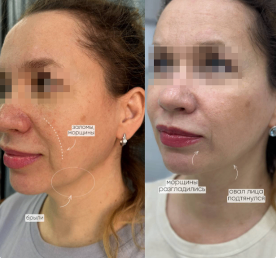 529113943__https://filllin.ru/api/media/doctor/2cb80093-65dc-49c2-963e-636cbf7f5d09-68d2b334d611ae3c0dcef079.png