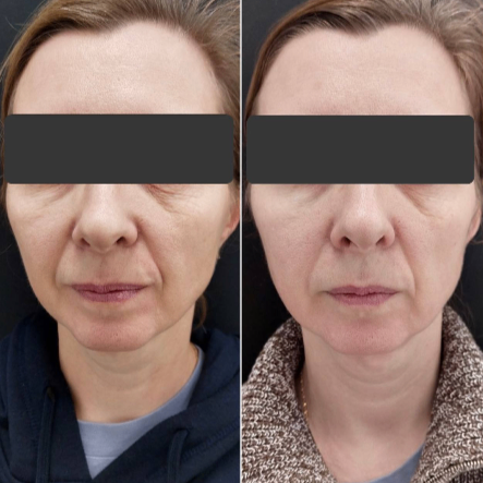 353029158__https://filllin.ru/api/media/doctor/2d0942d3-7db2-4c09-a6e6-9d7e72c662fd-6641d6971b708b73903b2c1d.png