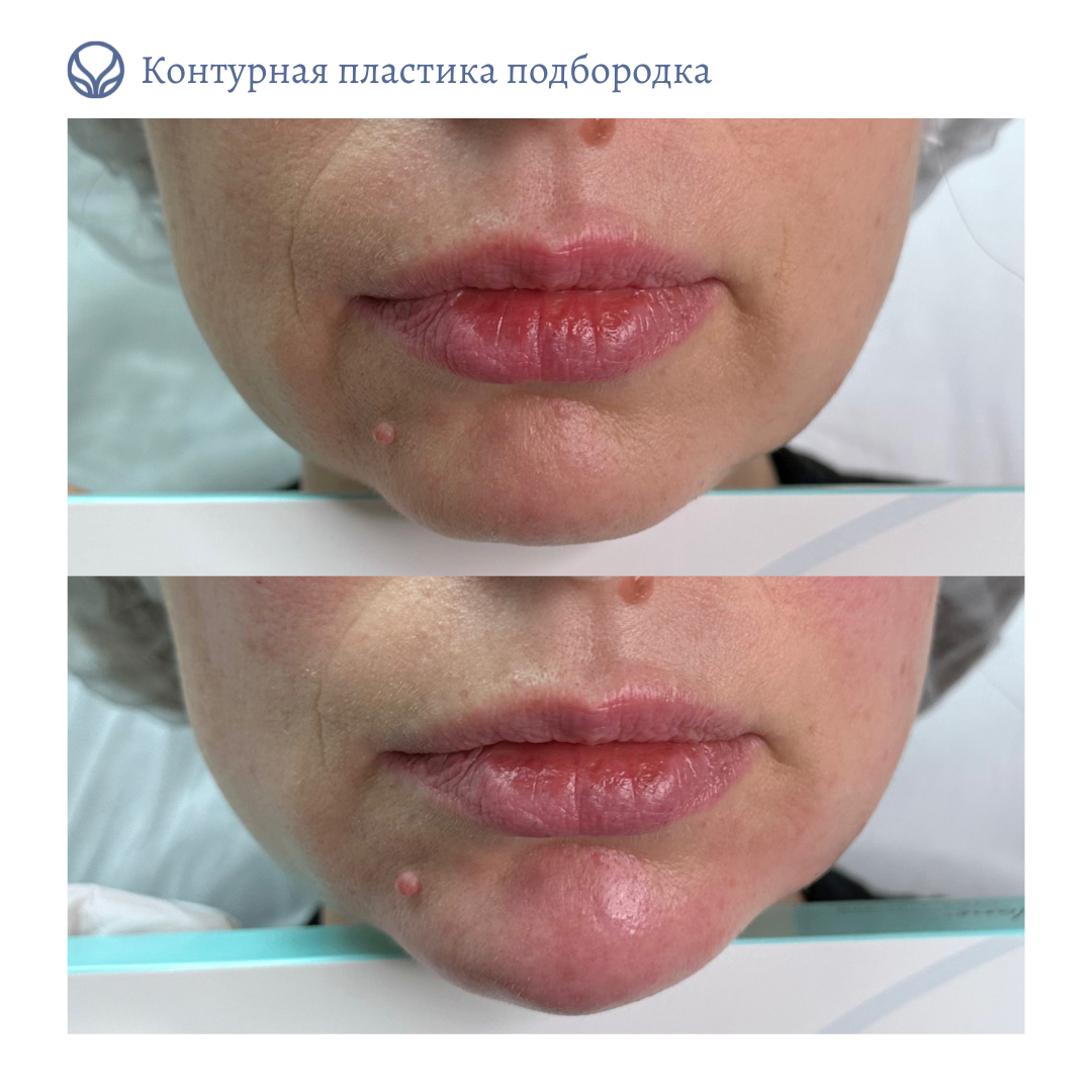 64844681__https://filllin.ru/api/media/doctor/2e98ead1-be45-4561-a1e7-3e523cc027f8-6641d6971b708b73903b2c1d.png