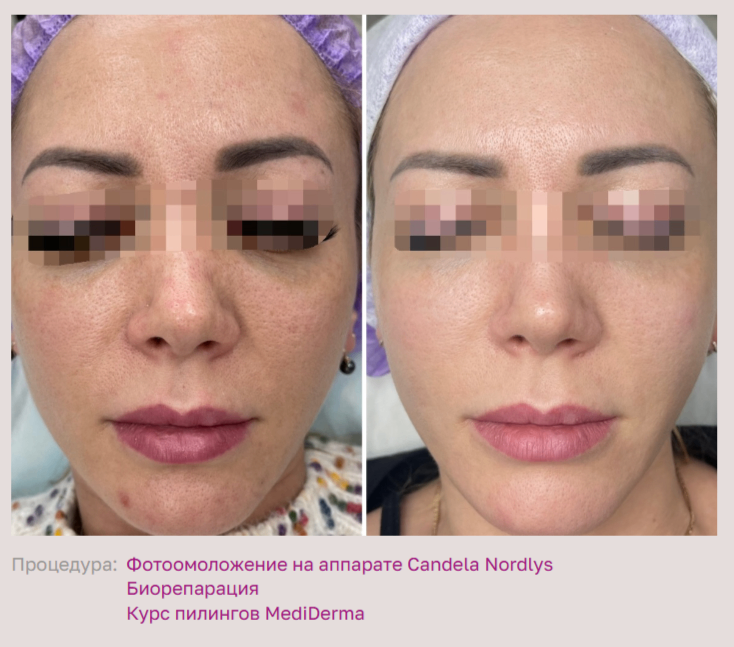 587358550__https://filllin.ru/api/media/doctor/343384bd-adf9-423c-87b8-64e8f7057855-68d2b334d611ae3c0dcef079.png