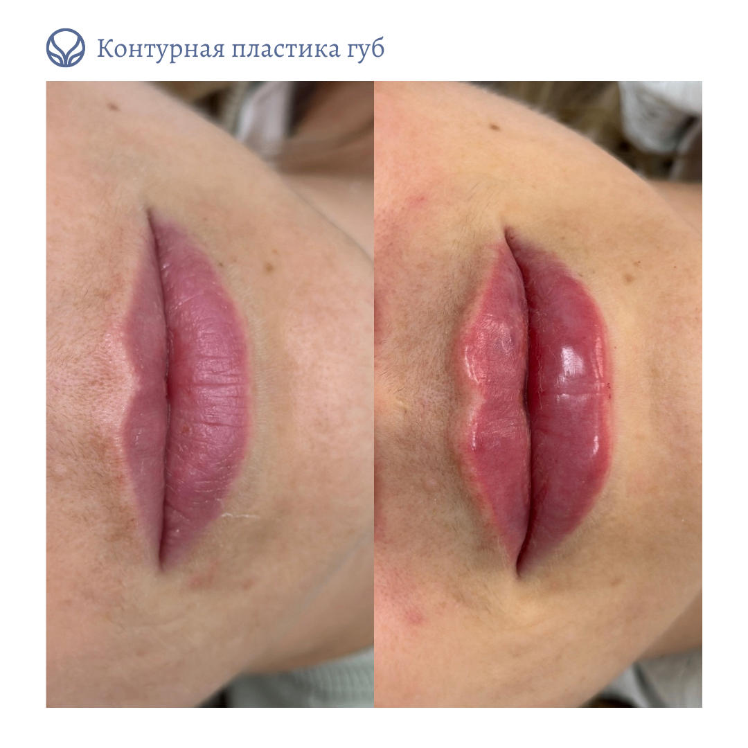 63423279__https://filllin.ru/api/media/doctor/376edbd2-da59-437d-9cf6-8543fbe84560-6641d6971b708b73903b2c1d.png