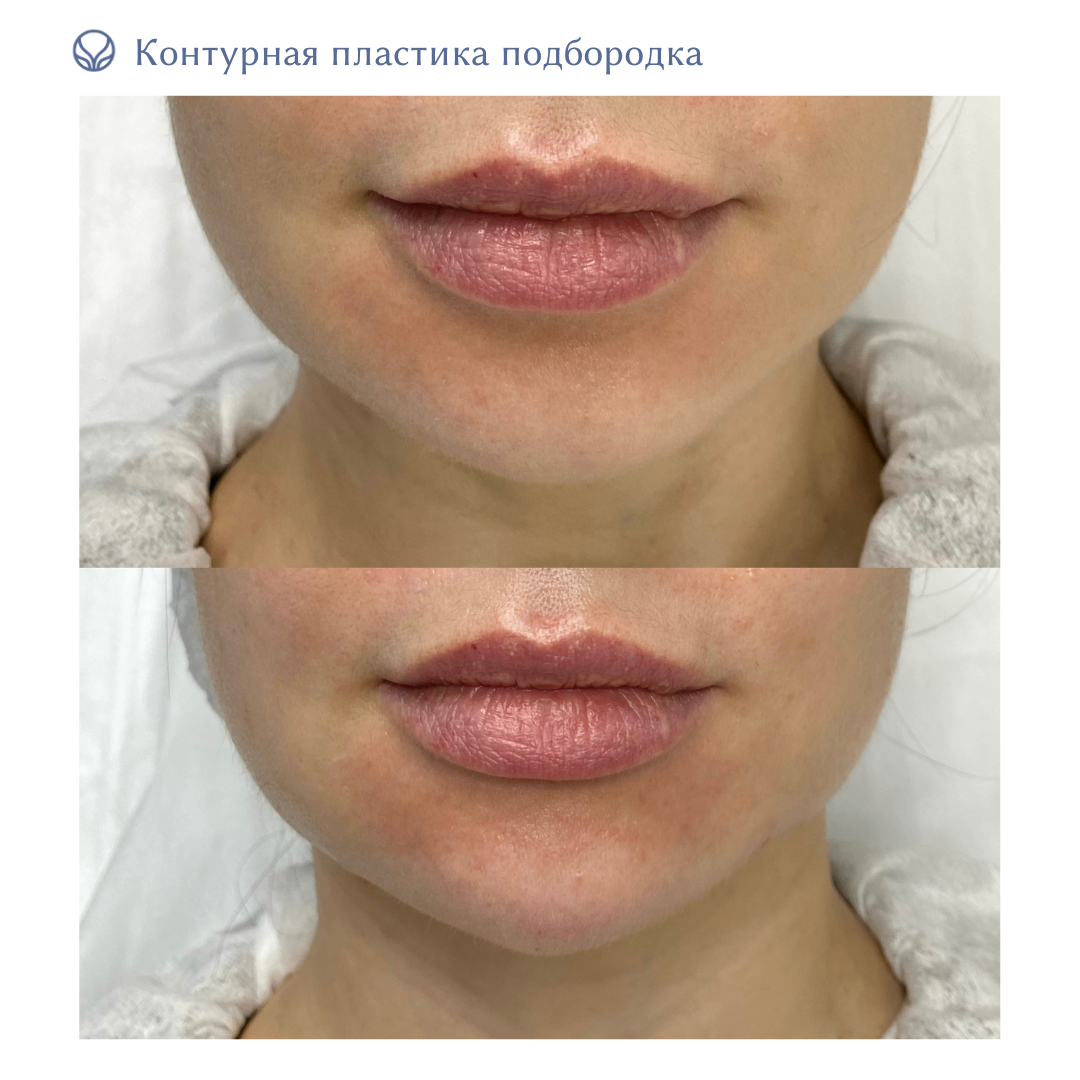 64844681__https://filllin.ru/api/media/doctor/37a611ad-901f-4d94-b8a3-3dc53dcfb9fe-6641d6971b708b73903b2c1d.png
