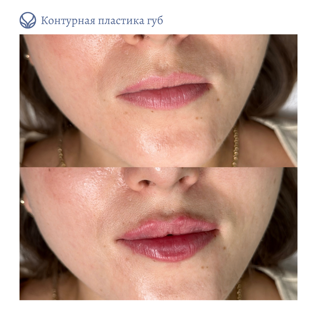 63423279__https://filllin.ru/api/media/doctor/38ad3238-1aa7-4a0a-8886-240eb547abf5-6641d6971b708b73903b2c1d.png
