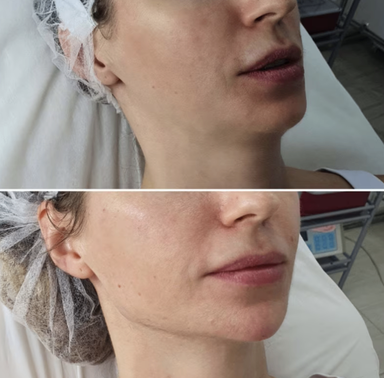 131568346__https://filllin.ru/api/media/doctor/38bbf013-c5ae-466d-9678-4e9b32c92207-6641d6971b708b73903b2c1d.png