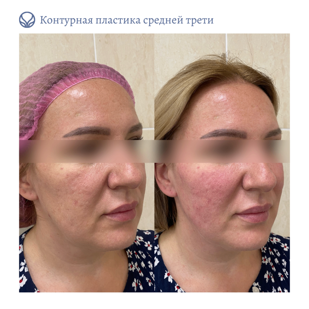 64844681__https://filllin.ru/api/media/doctor/38fde912-2694-492a-a8af-8454ec333369-6641d6971b708b73903b2c1d.png