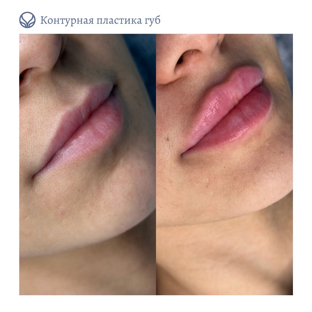 63423279__https://filllin.ru/api/media/doctor/396b84ca-a2e4-4382-9b6f-5ffd8da56bdc-6641d6971b708b73903b2c1d.png