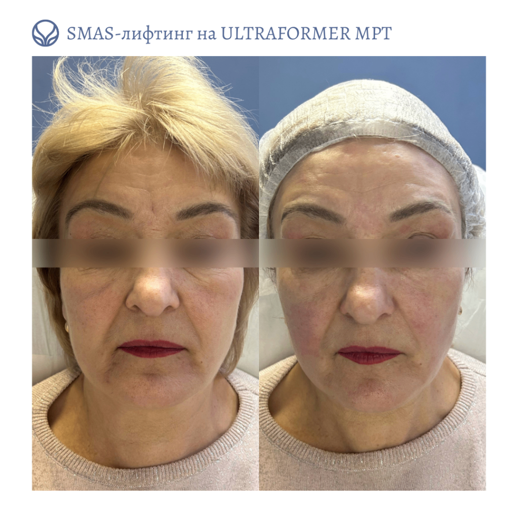 63532625__https://filllin.ru/api/media/doctor/3bfdc418-db7b-4161-a48d-879c9052bd01-6641d6971b708b73903b2c1d.png