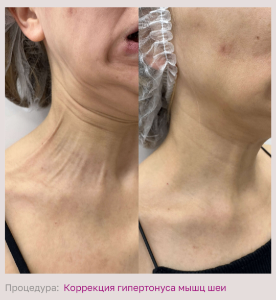 602492197__https://filllin.ru/api/media/doctor/3c469752-9dfa-4c8c-9330-891ca5e5db6f-68d2b334d611ae3c0dcef079.png