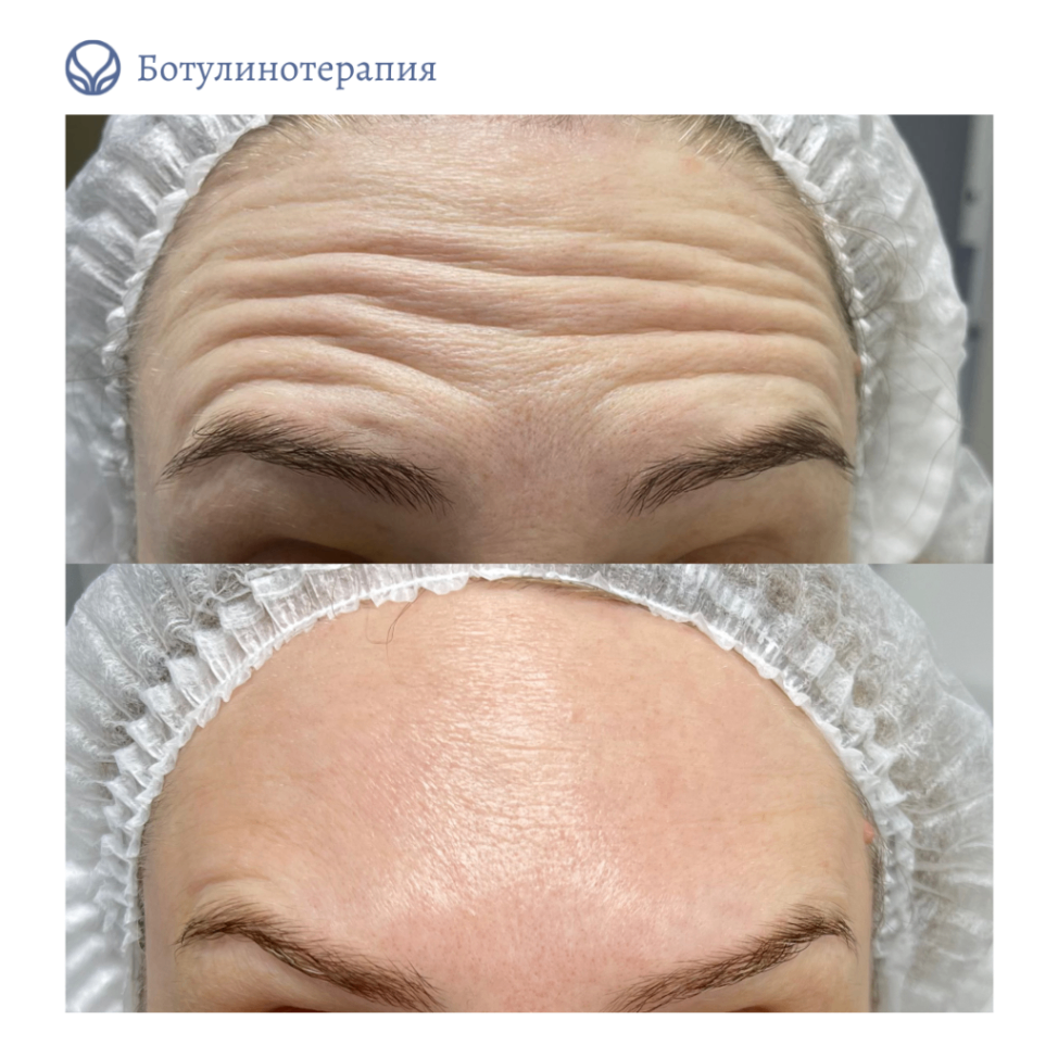 62014032__https://filllin.ru/api/media/doctor/3c8addc4-bdc1-4bd9-8a13-32b6fd2e8339-6641d6971b708b73903b2c1d.png