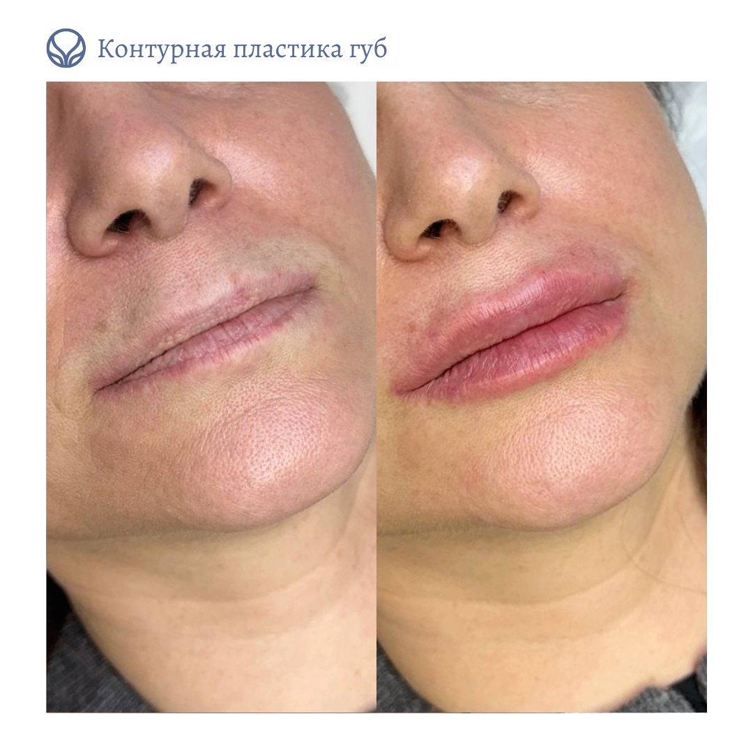 63553855__https://filllin.ru/api/media/doctor/3caccb0f-48d6-4381-a11a-8d21309ccac5-6641d6971b708b73903b2c1d.png