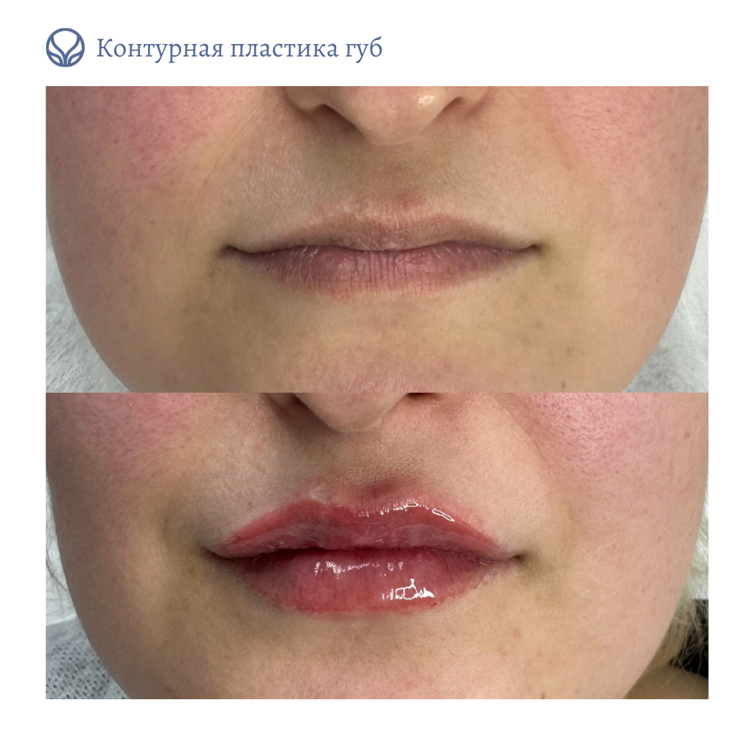 75035740__https://filllin.ru/api/media/doctor/3d223270-bb4e-42bb-940d-029c84327a99-6641d6971b708b73903b2c1d.png