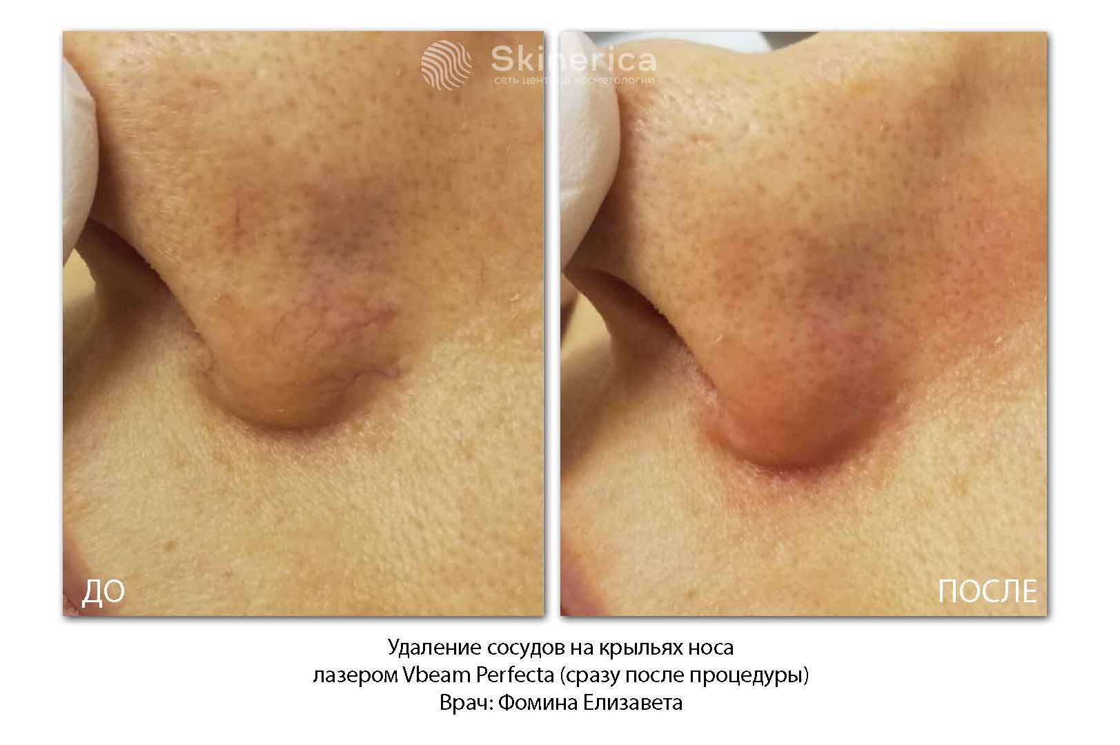 210725569__https://filllin.ru/api/media/doctor/40e4ac15-953e-45a5-b3ad-b7a86893d3d0-6641d6971b708b73903b2c1d.jpg