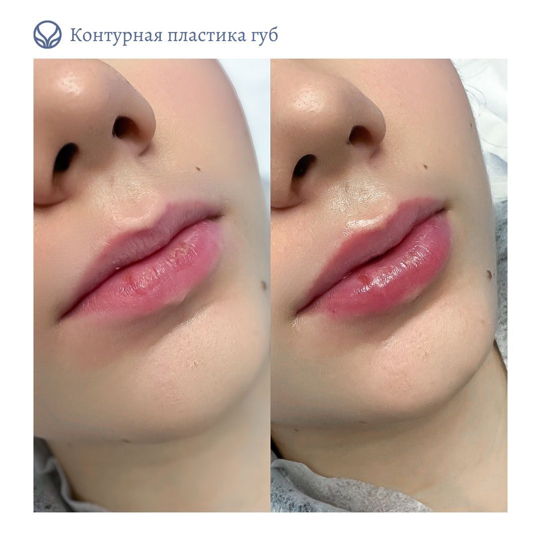 63553855__https://filllin.ru/api/media/doctor/41509025-95c9-4524-b655-3b0cedd28ffb-6641d6971b708b73903b2c1d.jpg