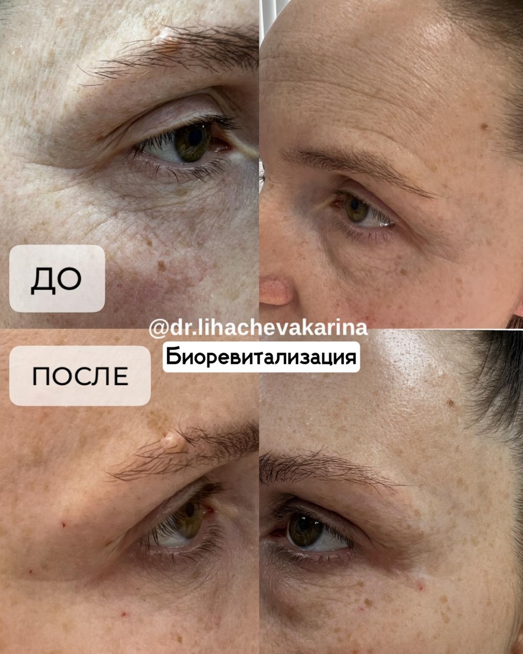 352217649__https://filllin.ru/api/media/doctor/41c0c435-e740-4a13-a364-fcaaac714473-6641d6971b708b73903b2c1d.jpg