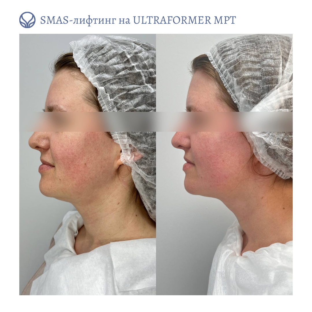 64586679__https://filllin.ru/api/media/doctor/439c6977-9a2f-4b5a-a2ae-1c272a64af4d-6641d6971b708b73903b2c1d.png
