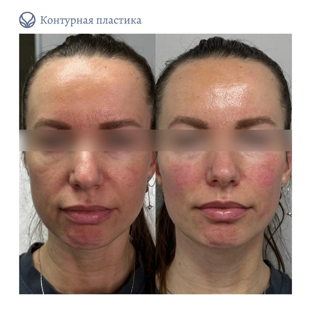 64844681__https://filllin.ru/api/media/doctor/43aaaaec-795e-493b-9f22-c5401bbbefb5-6641d6971b708b73903b2c1d.png