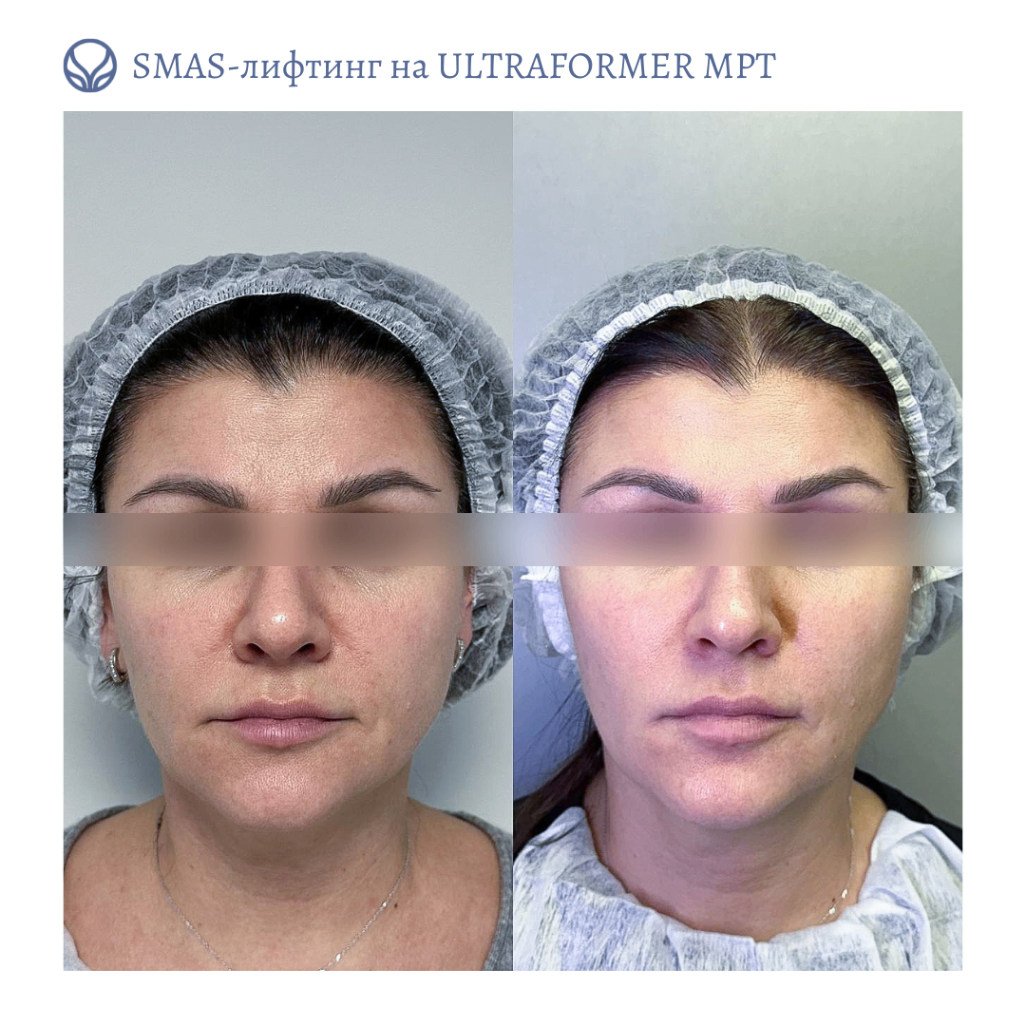 63553855__https://filllin.ru/api/media/doctor/448bdbfc-a4f6-4be5-9156-4c5825397c0b-6641d6971b708b73903b2c1d.png