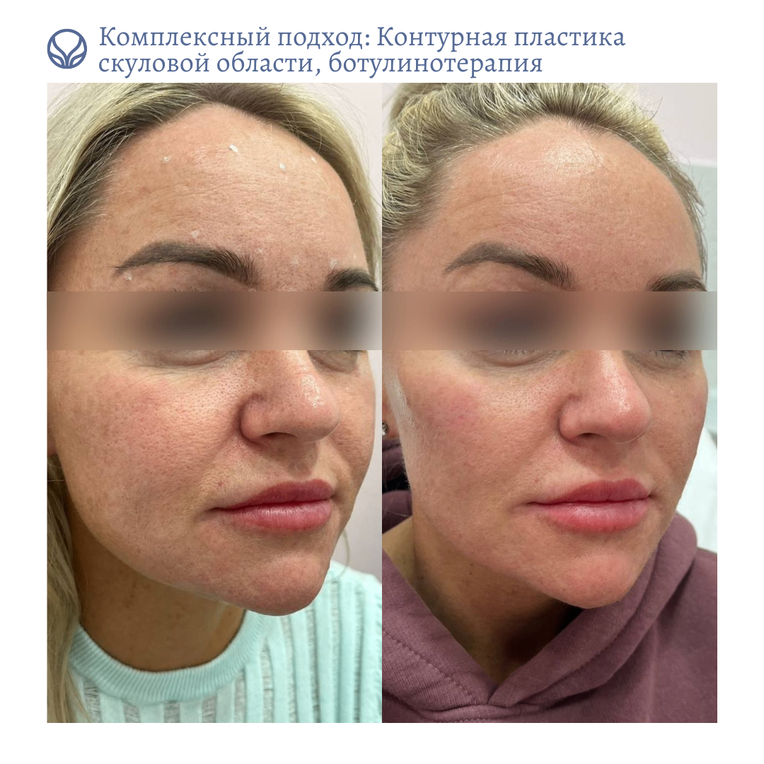 69138892__https://filllin.ru/api/media/doctor/44df4909-6dd8-4d8c-a524-11b8175d110d-6641d6971b708b73903b2c1d.png