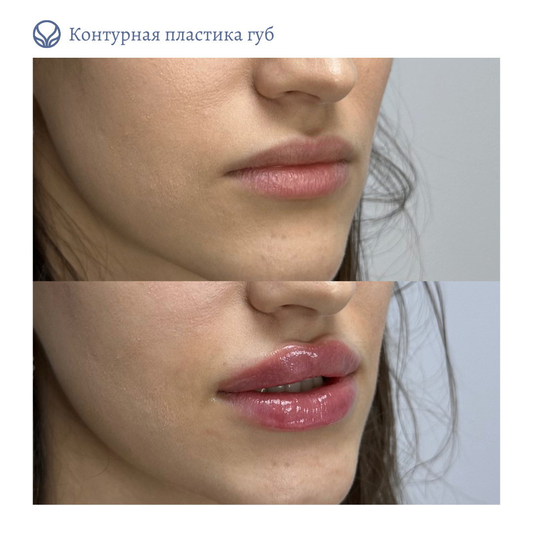 64844681__https://filllin.ru/api/media/doctor/476f3971-5410-4664-b6d9-0c5ffb2d582f-6641d6971b708b73903b2c1d.png