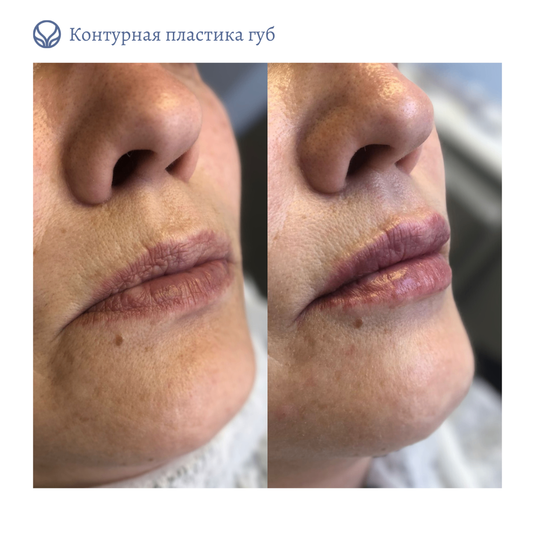 63553855__https://filllin.ru/api/media/doctor/48bba2c7-9044-4c62-b9d0-a08e35c3eab5-6641d6971b708b73903b2c1d.png